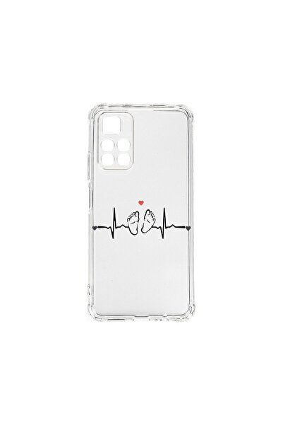 bestcase Husa BestCase¬Æ Anti Shock 1.5MM, Compatibila Cu Xiaomi Poco M4 Pro ...