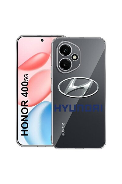 bestcase Διαφανής Θήκη Σιλικόνης για Honor 400, Hyundai, 2036423 T 1724