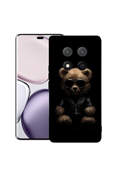 bestcase Θήκη για Honor Magic 7 Lite, Προστατευτική λεπτή θήκη σιλικόνης Prem...