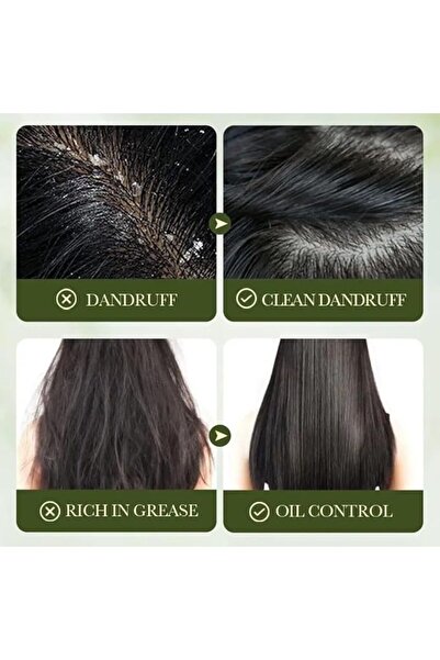 SADOER Olives Oil Squalane Shampoo Dandruff Remover Anti-Itch Multi Effect For All Hair 500ml