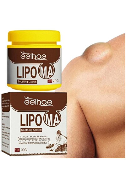 EELHOE Lipoma Removal Cream, Herbal Body Care Balm, Lipoma Removal Cream Oint...