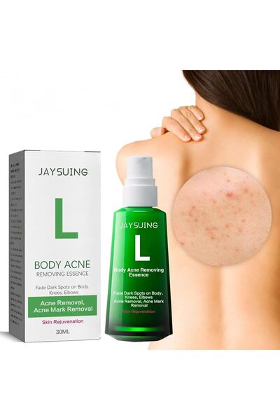 jaysuing Body Acne Removing, Fade Dark Spots on Body- Knees Elbows Mark Remov...