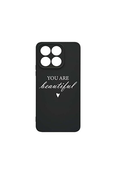 bestcase Husa BestCase¬Æ Premium Liquid Silicon, Compatibila Cu Honor X8a, Yo...