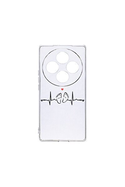 bestcase Θήκη Διαφανής Σιλικόνη 2MM, Συμβατή με OPPO Reno12 FS / Reno12 F, My...