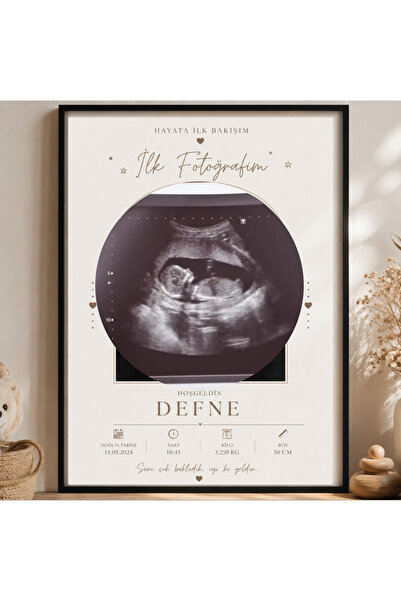 EMRcollection BEBEK TABLO - ULTRASON FOTOĞRAF ÇERÇEVESİ- HAMİLE HEDİYE