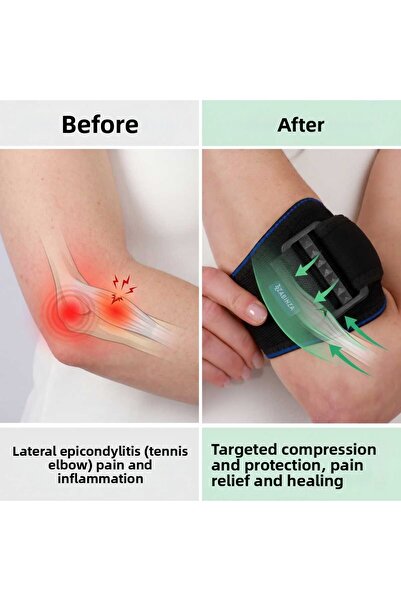 zabinza Epicondylitis Bandage - Epicondylitis Support Tennis & Golf Elbow Ban...