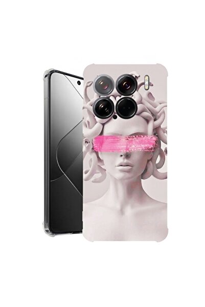bestcase Θήκη για Xiaomi 15, Αντικραδασμική 1.5MM, Μέδουσα, Προστασία κάμερας...