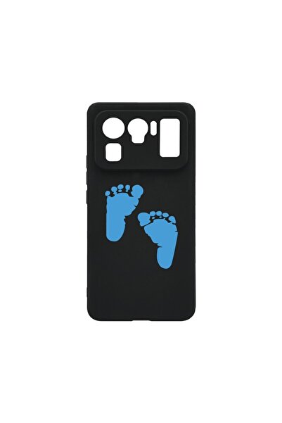 bestcase Husa BestCase¬Æ Slim SIlicon 0.8MM, Compatibila Cu Xiaomi Mi 11 Ultr...