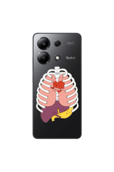 Other Xiaomi Redmi Note 13 4G Anatomy Transparent Silicone TPU Θήκη