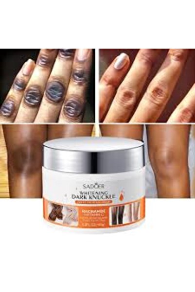 SADOER Dark Knuckle Whitening Cream Knuckles, Elbows, Knees & Underarms | Moi...