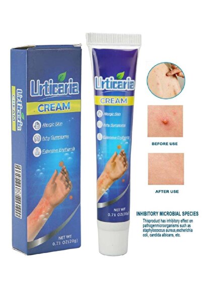 SUMIFUN Urticaria Cream Ointment for Allergic Reactions, Skin Rash Relief, Re...