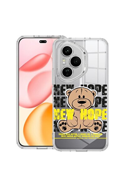 bestcase Прозрачен силиконов калъф за Honor 400 Pro, Мече Нова надежда, 20364...