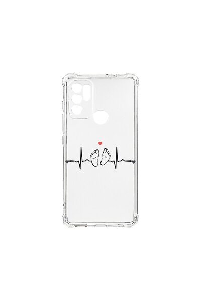 bestcase Αντικραδασμική Θήκη 1.5MM, Συμβατή με Motorola Moto G60s, My Little ...