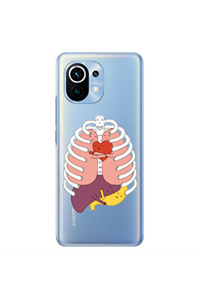 Other Xiaomi Mi 11 Anatomy Transparent Silicone TPU Θήκη