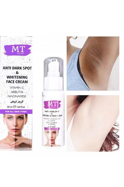 MT 50ml Anti-Blemish and Whitening Face and Body Cream