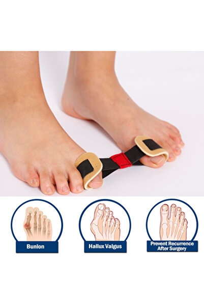 choice2 Type A-1Pcs Pexmen 1/2Pcs Big Toe Strap Bunion Straightener Stretchy ...