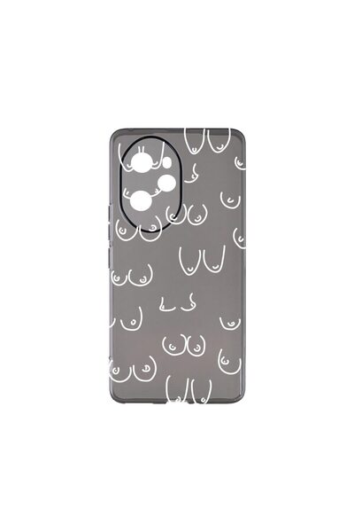 bestcase Θήκη Σιλικόνης Γραφίτη 1.5MM, Συμβατή με Honor X8a, Αντικραδασμική, ...