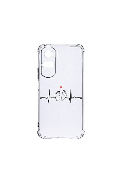 bestcase Αντικραδασμική Θήκη 1.5MM, Συμβατή με Honor 90 Lite, My Little Love,...