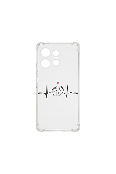 bestcase Αντικραδασμική Θήκη 1.5MM, Συμβατή με Motorola Edge 50 Pro, My Littl...