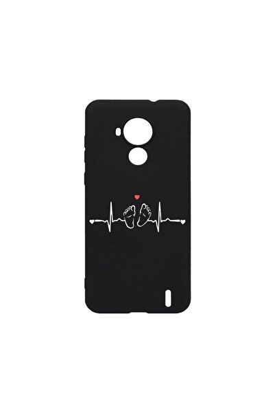 bestcase Λεπτή Θήκη Σιλικόνης 0.8MM, Συμβατή με Nokia C30, My Little Love, Αν...