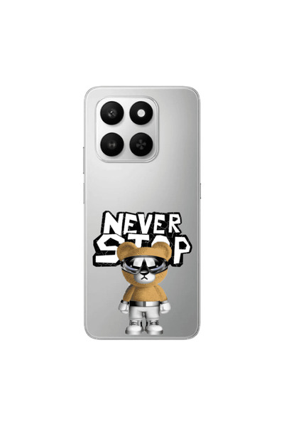 Other Honor Magic 400 Smart Never stop Transparent Silicone TPU Θήκη