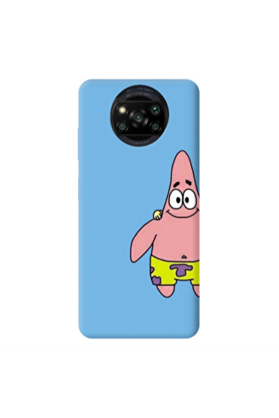 Other Xiaomi Poco X3 /X3 Pro Spong 1 Blue Colored Silicone TPU Θήκη