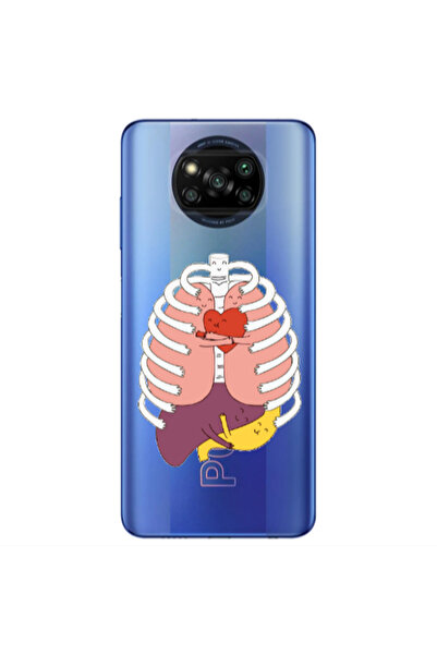 Other Xiaomi Poco X3 /X3 Pro Anatomy Transparent Silicone TPU Θήκη