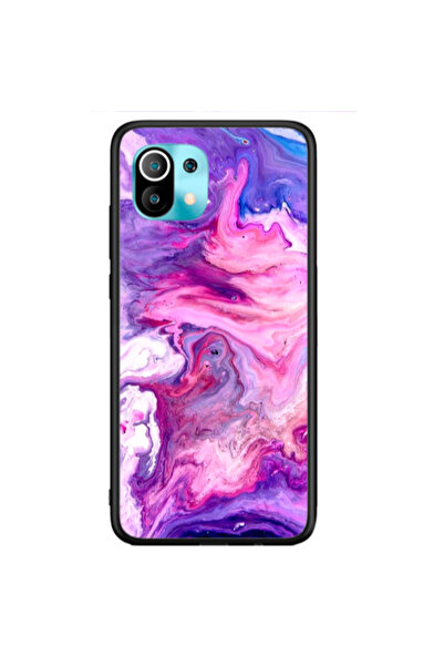 Other Xiaomi Mi 11 Marble art Black Glossy Θήκη