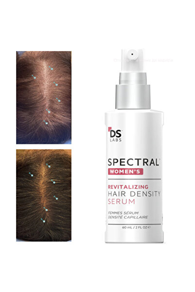 GYB Spectral Ser pentru femei împotriva căderii părului cu Nanoxidil 5% – Tra...