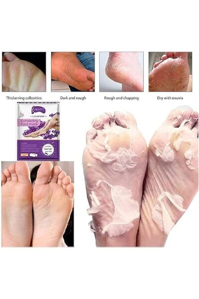 aliverystore Foot Peel Masks, Natural Exfoliant Peeling Away Calluses and Dea...