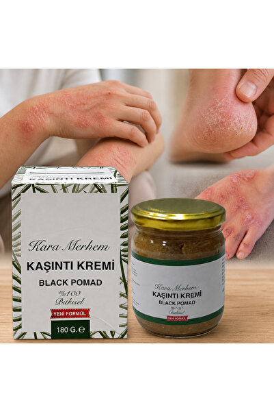 sarayli baharat Ardıç Katranlı Egzema Mantar Kremi 150 Ml Özel Üretim