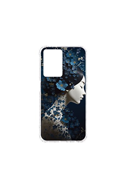 bestcase Husă Antișoc 1.5MM, compatibilă cu OPPO A57 / A57s / A77 / A77s, Thi...
