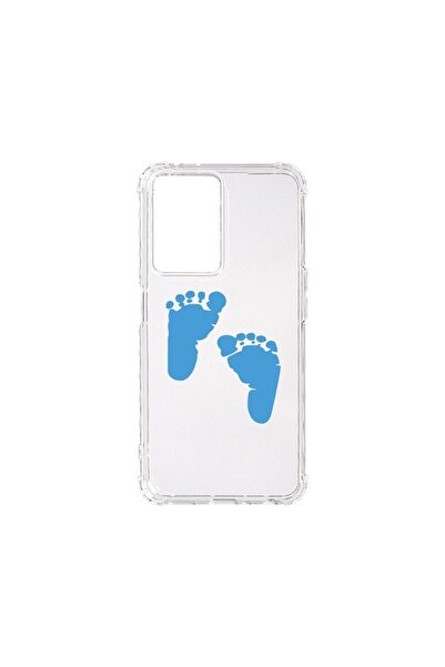 bestcase Husa BestCase¬Æ Anti Shock 1.5MM, Compatibila Cu OPPO A57s, Boy Feet...
