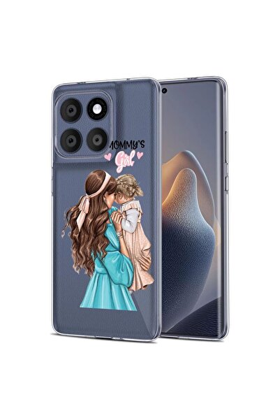 bestcase Husa pentru Motorola Edge 60 Fusion 5G, BestCase¬Æ Clear Silicon 2MM...