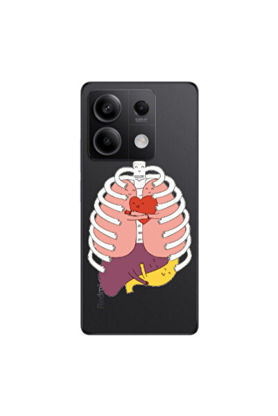 Other Xiaomi Redmi Note 13 5G Anatomy Transparent Silicone TPU Θήκη