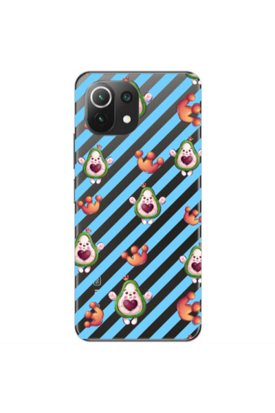 Other Xiaomi Mi 11 Lite king avocado Transparent Silicone TPU Θήκη