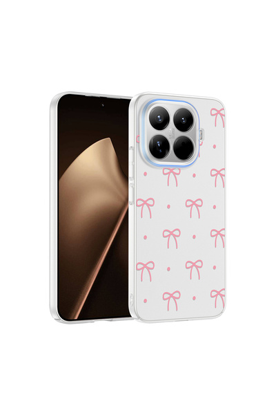 Ummeslem غطاء حماية متوافق مع هاتف شاومي 15T Pro مع حماية للكاميرا وتصميم مزخرف