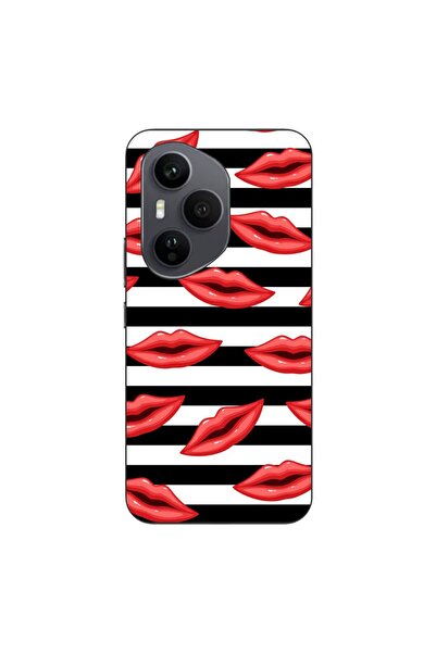 OEM Husa compatibila cu Honor 400 Pro Silicon Gel Tpu Model Striped Kisses