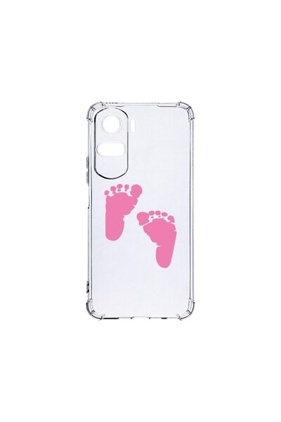 bestcase Husa BestCase¬Æ Anti Shock 1.5MM, Compatibila Cu Honor 90 Lite, Girl...