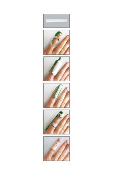 Case Finger Splint