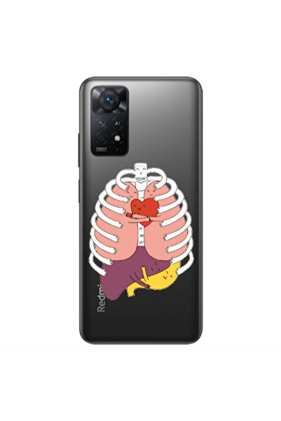 Other Xiaomi Redmi Note 11 4G Anatomy Transparent Silicone TPU Θήκη