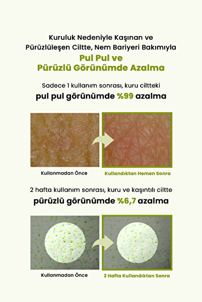 zeroid Aşırı Kuru Hassas Cilde Bariyer Desteği Sunan Yoğun Nemlendirici Krem Intensive Cream