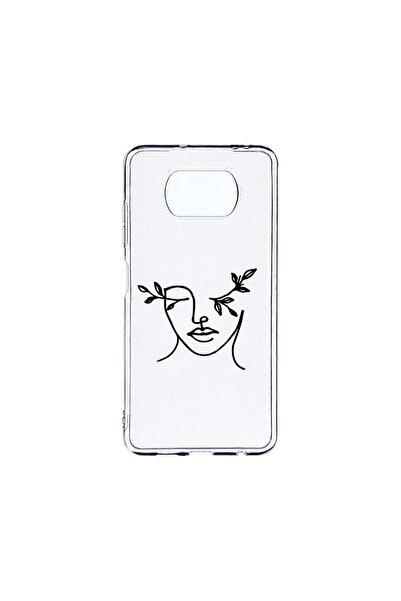 bestcase Husa BestCase¬Æ Clear Silicon 2MM, Compatibila Cu Xiaomi Poco X3 Pro...