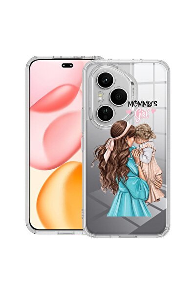 bestcase Прозрачен силиконов калъф за Honor 400 Pro, Маминото момиче, 2036424...
