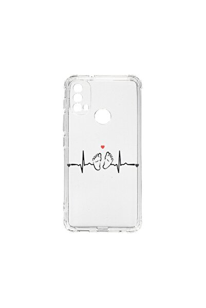 bestcase Husa BestCase¬Æ Anti Shock 1.5MM, Compatibila Cu Motorola Moto E20, ...