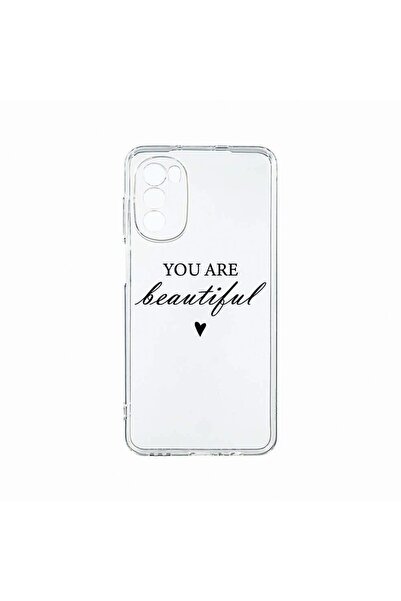 bestcase Θήκη Σιλικόνης, Συμβατή με Motorola Moto G82 / Moto G52, Είσαι Όμορφ...
