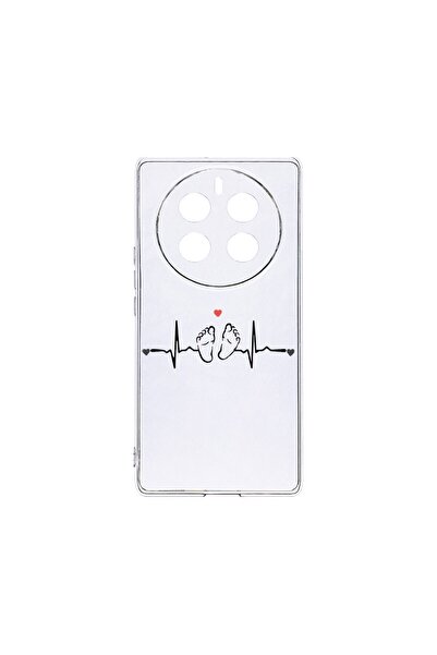 bestcase Husa BestCase® Silicon transparent 2MM, Compatibilă cu Realme 12 Pro...