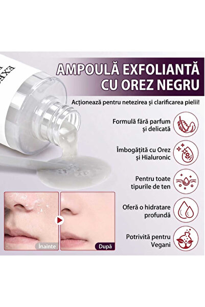 NOVA KISS Ser exfoliant delicat cu extract de orez negru și niacinamidă, 100ml