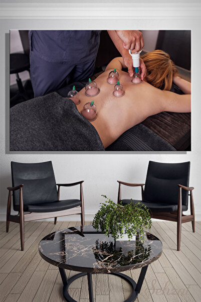 Canvas Wall Table Horizontal Single Physiotherapist Alternative Medicine Mug Therapy Cup Pulling Hijama
