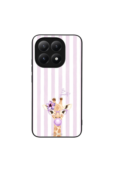OEM Θήκη Sonique Stripe Stories Series για Xiaomi Xiaomi 15T 5G Λιλά- Καμηλοπ...